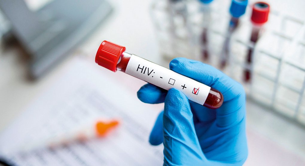 Rekordní počet nakažených HIV